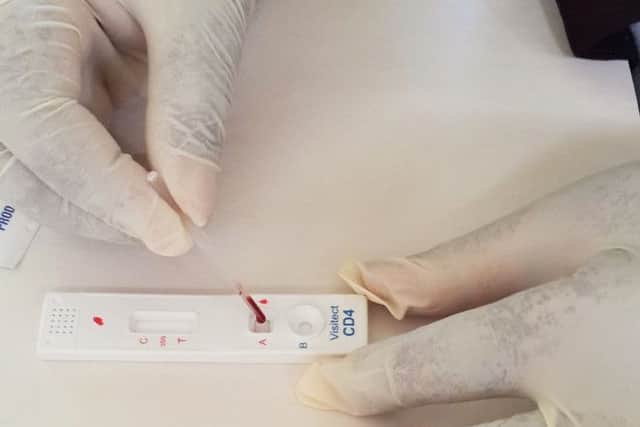 Omega's Visitect CD4 product enables people with HIV to test their immune systems. Picture: Contributed