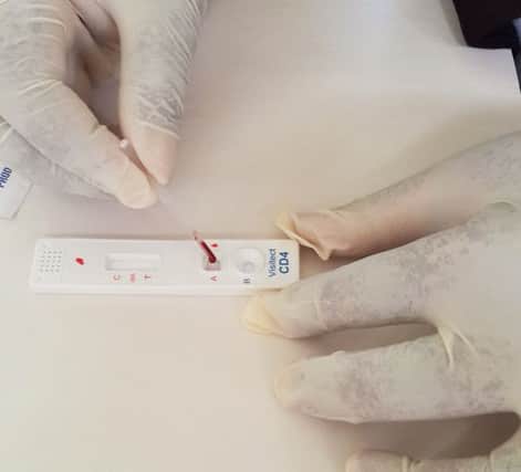 Omega's Visitect CD4 product enables people with HIV to test their immune systems. Picture: Contributed