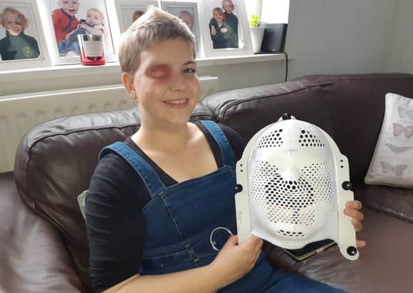 Cancer sufferer Toni Crews with her plastic radiotherapy mask. Picture: SWNS