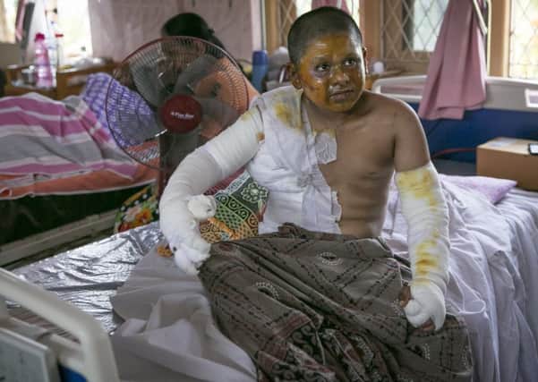 Ten-year-old Ashayal Rosairo was injured in an attack on the Zion church in Batticaloa, Sri Lanka (Picture: Allison Joyce/Getty Images)
