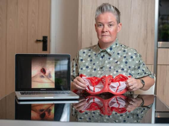 Lynne McConnell with a photograph of her chest wound. Picture: SWNS