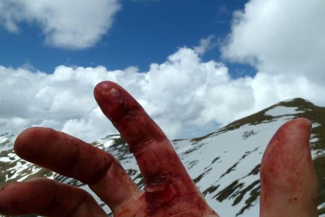 One of his hands after the attack.