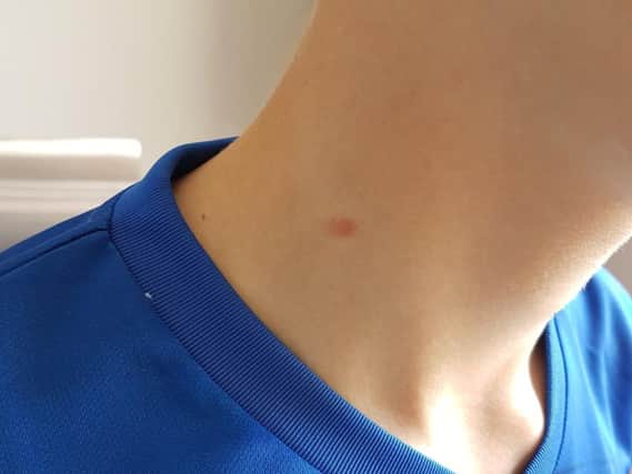 School pupil claims he was shot in the neck.