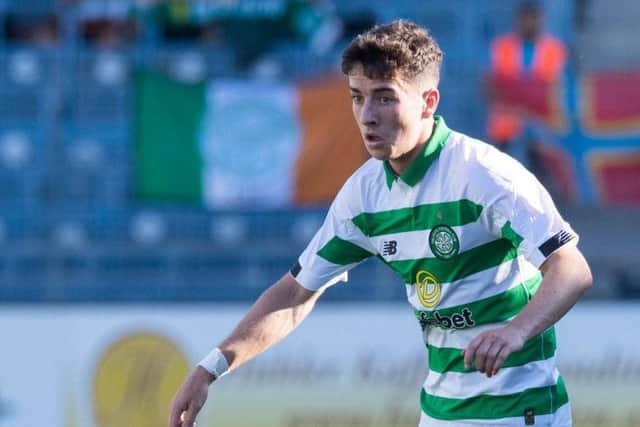 Mikey Johnston scored the equaliser for Celtic but was forced off with an injury in the second half