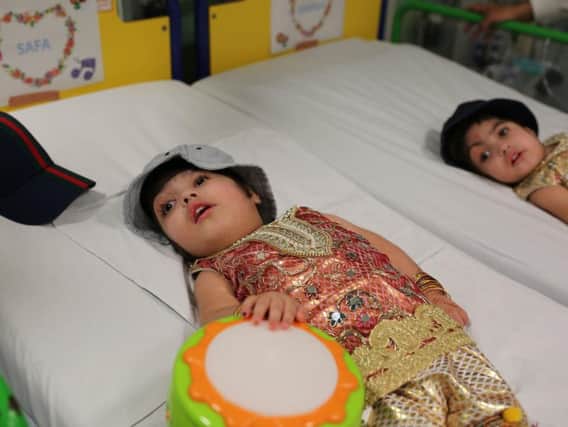 Two-year-old sisters Safa and Marwa Ullah, from Charsadda in Pakistan, underwent three major operations to separate their heads at Great Ormond Street. Picture: PA