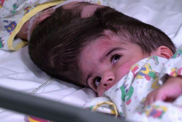 The girls, whose father has died, were discharged from Gosh on July 1. Picture: PA