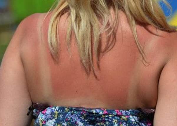There are sunburn warnings amid a heatwave. Picture: PA