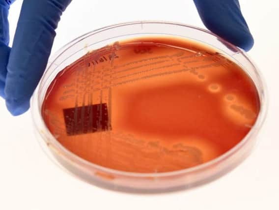 The bugs include strains of bacteria that can trigger life-threatening illnesses