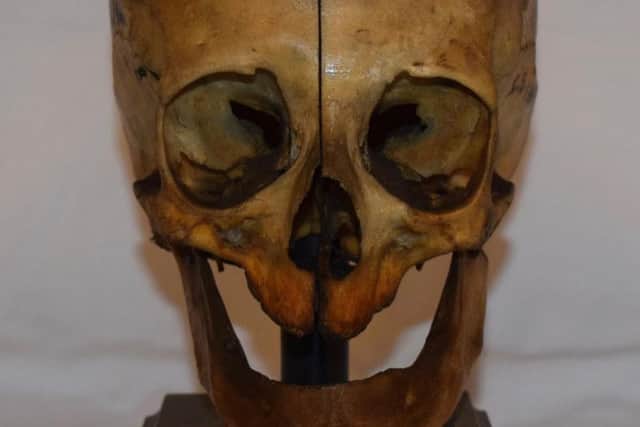 The model was made from one of six Druid skulls that were donated to the Anatomical Collection at the University of Edinburgh in the early 19th Century. PIC: Contributed.