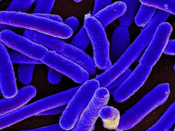 Health Protection Scotland have issued the warning about E.coli at an Egyptian resort