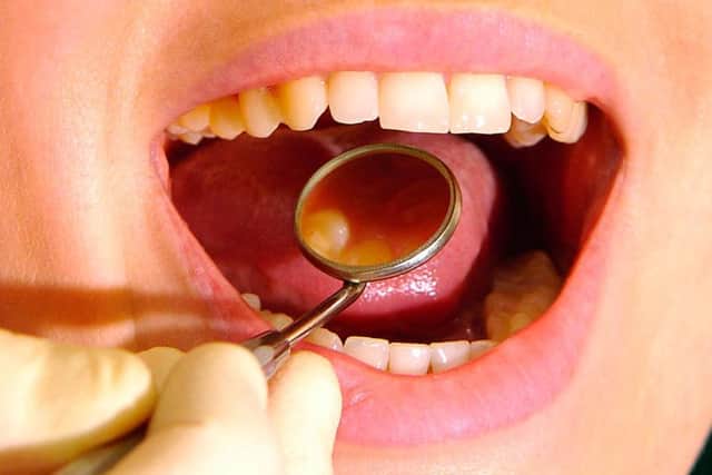 Bumper funding round for Calvicis to bring tooth decay treatment to worlds largest dental sector. Picture: Contributed