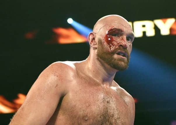 Tyson Fury sustained a gaping gash over his right eye and also a smaller one on the eyelid. Picture: Getty.