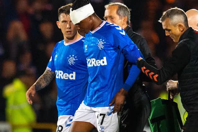 Joe Aribo is helped off the pitch with his head bandaged