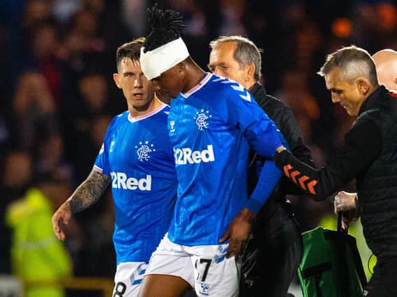 Joe Aribo is helped off the pitch with his head bandaged