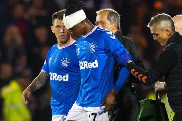 Joe Aribo needed 20 stitches in a head would. Picture: Craig Williamson/SNS