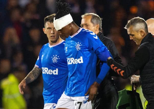 Joe Aribo needed 20 stitches in a head would. Picture: Craig Williamson/SNS