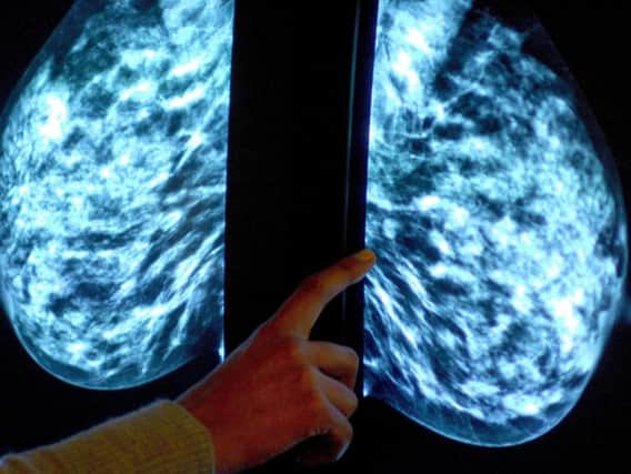 Screening for breast cancer being carried out