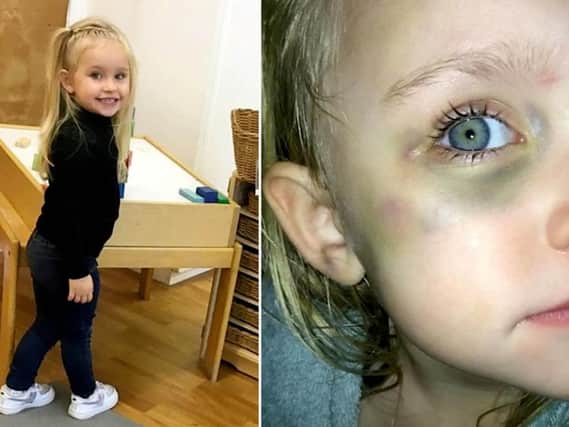 Lisa Roberts, 28, claims three-year-old Connie-Mae Sherratt "could have died" after she became pinned underneath the bookcase when she was left unattended. Picture: SWNS