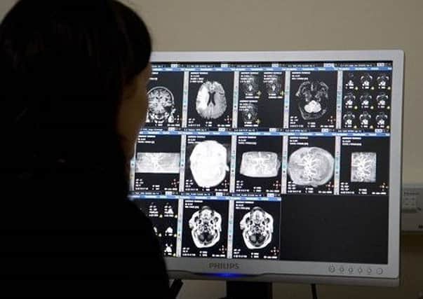 The number of stroke victims to have survived in Scotland has risen in recent years.