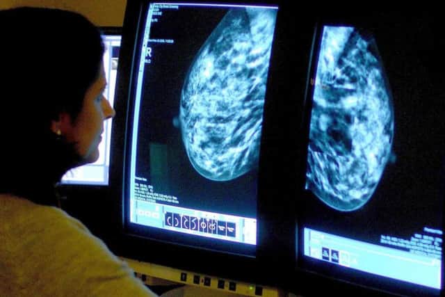 A breast cancer scan is observed