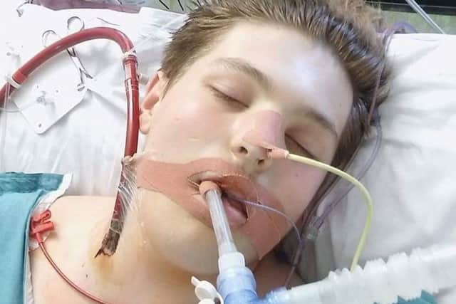 Ewan Fisher, 18, who was treated for hypersensitivity pneumonitis at Glenfield Hospital in Leicester. Picture: PA