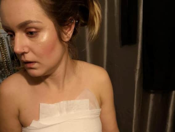 Stacey Andrew was near the front of the stage when she was struck by the lit projectile, which ignited her clothing and burned her skin underneath.