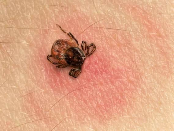 A tick biting through human skin, red blotches indicate an infection. Photograph: Getty Images