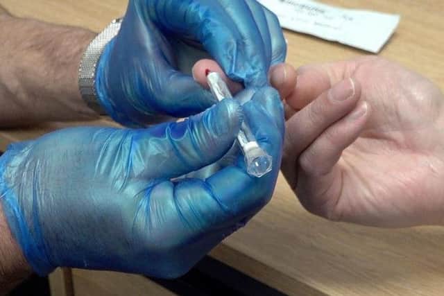 New HIV tests that provide results in minutes have been introduced in Glasgow.